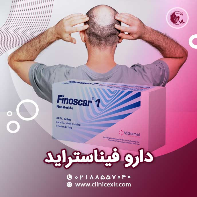 قرص فیناستراید