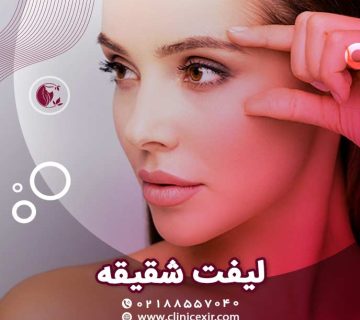 لیفت شقیقه