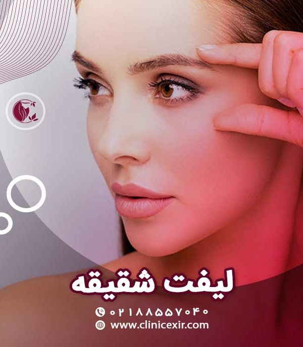 لیفت شقیقه