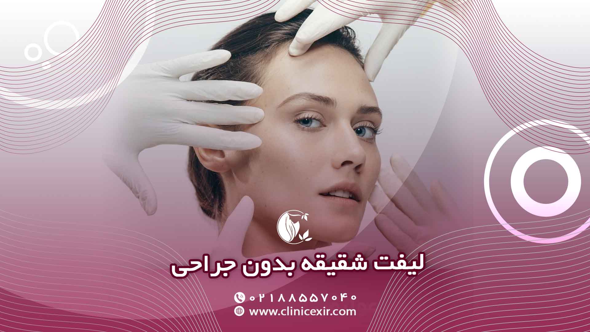 لیفت شقیقه بدون جراحی 