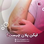 لیکن پلان چیست؟