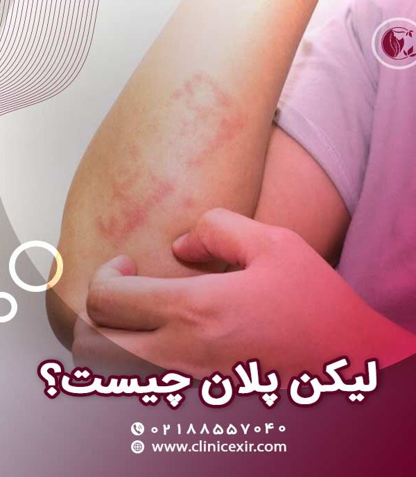 لیکن پلان چیست؟