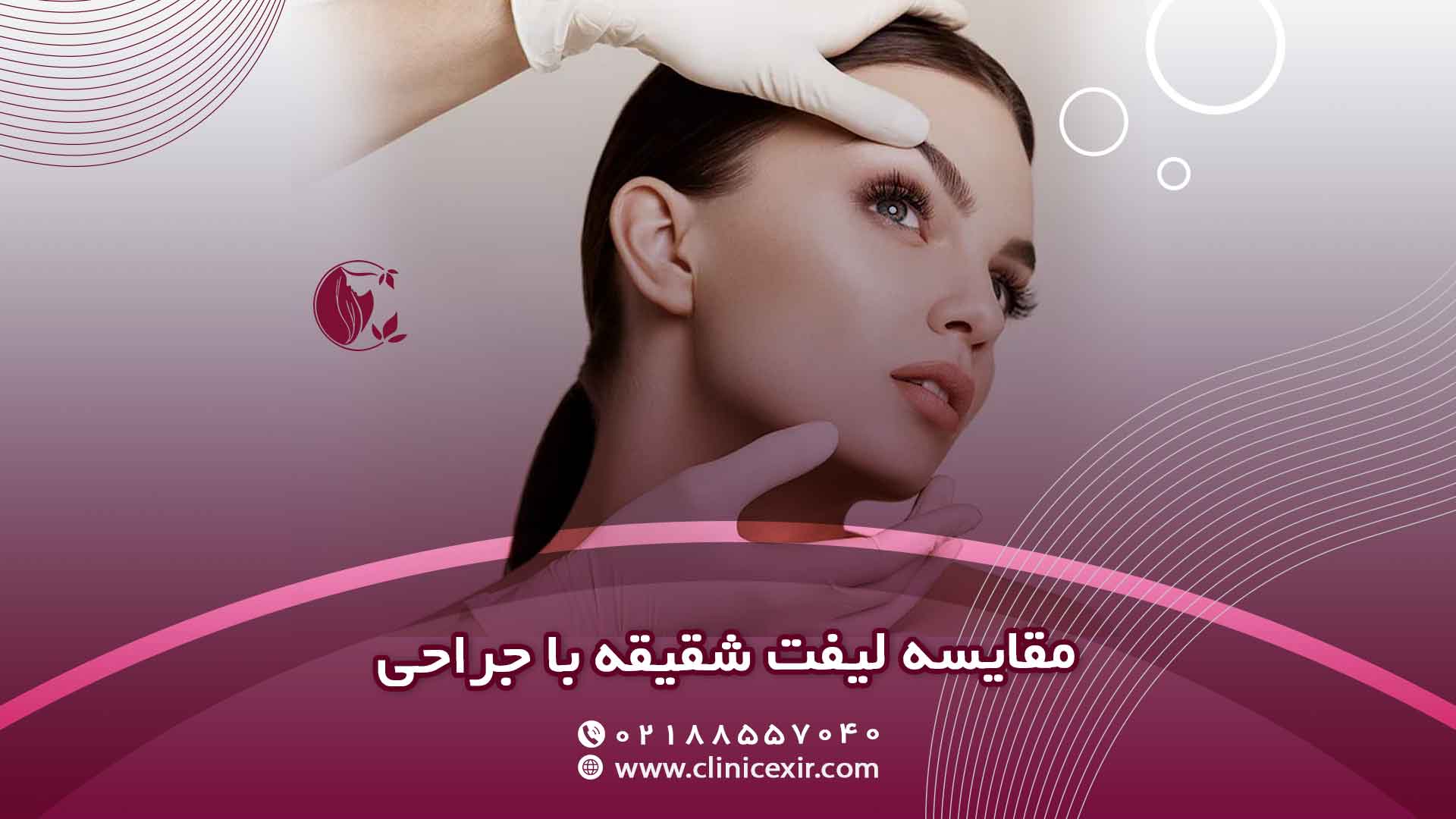 مقایسه لیفت شقیقه با جراحی آگاهی از تفاوت‌ها