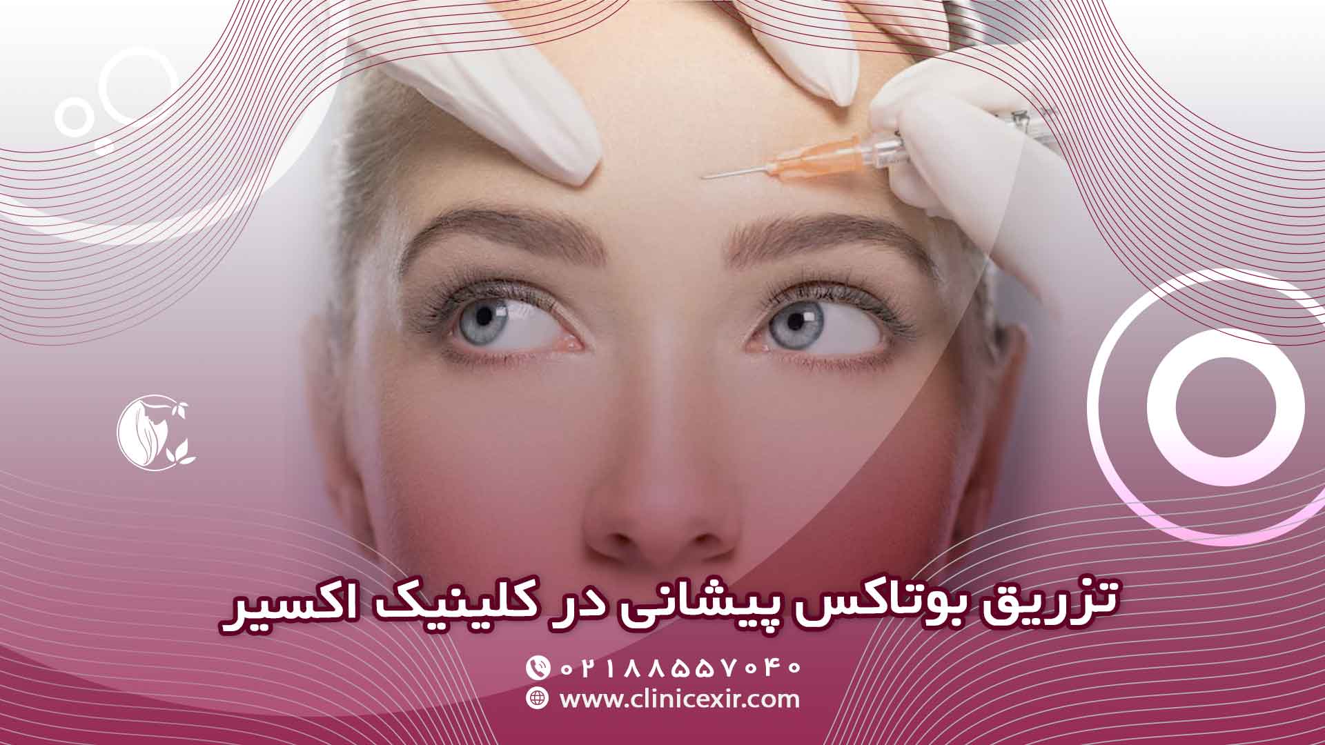 نحوه انجام تزریق بوتاکس پیشانی در کلینیک اکسیر
