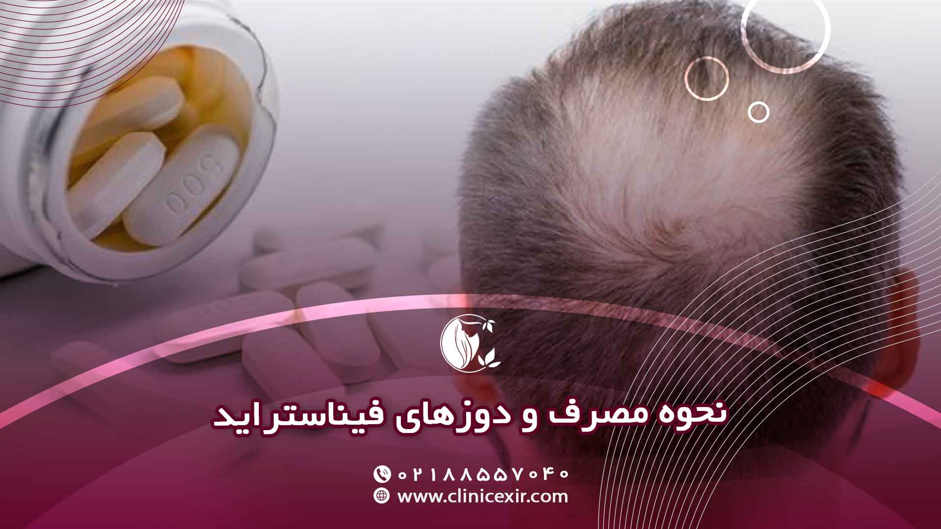 مصرف و دوزهای فیناستراید