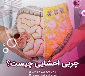 چربی احشایی