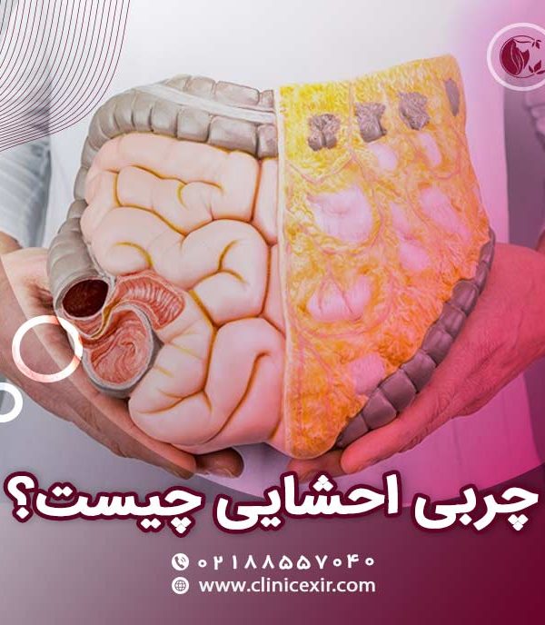 چربی احشایی