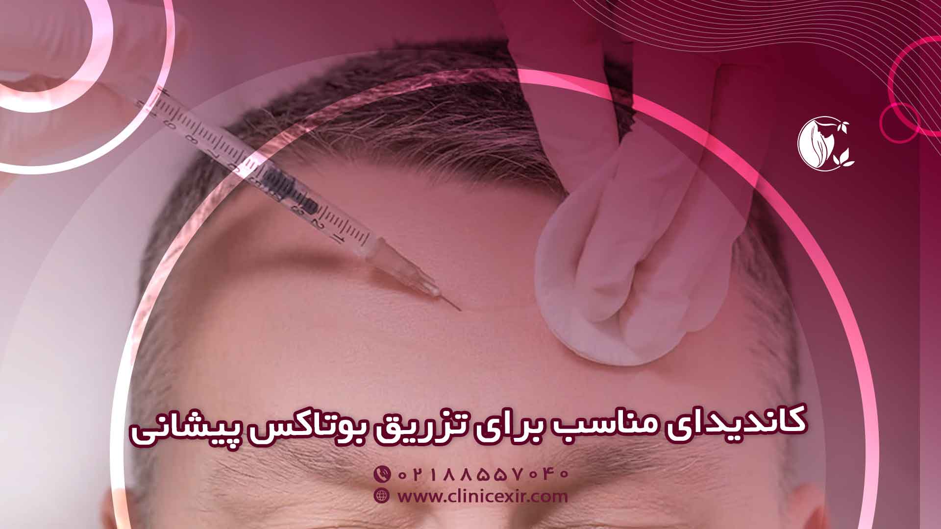 چه افرادی کاندیدای مناسب برای تزریق بوتاکس پیشانی هستند؟