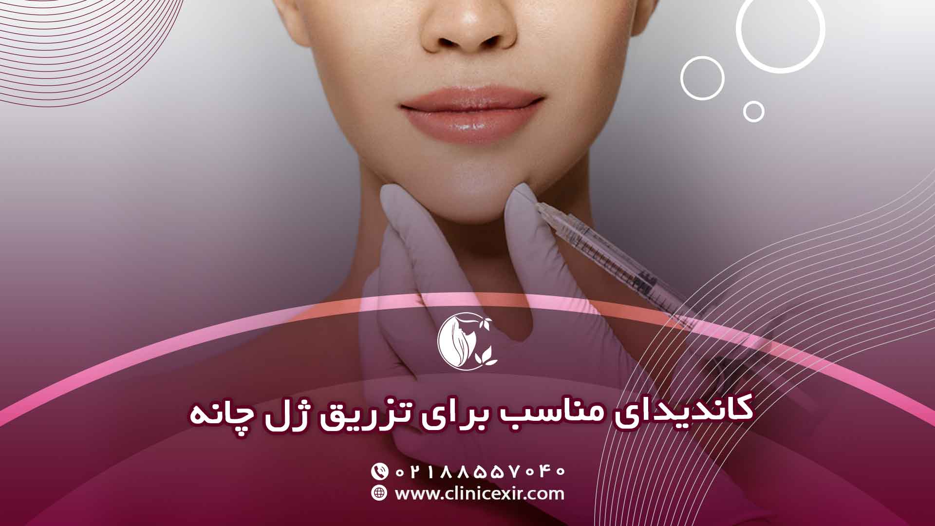 چه افرادی کاندیدای مناسب برای تزریق ژل چانه هستند؟