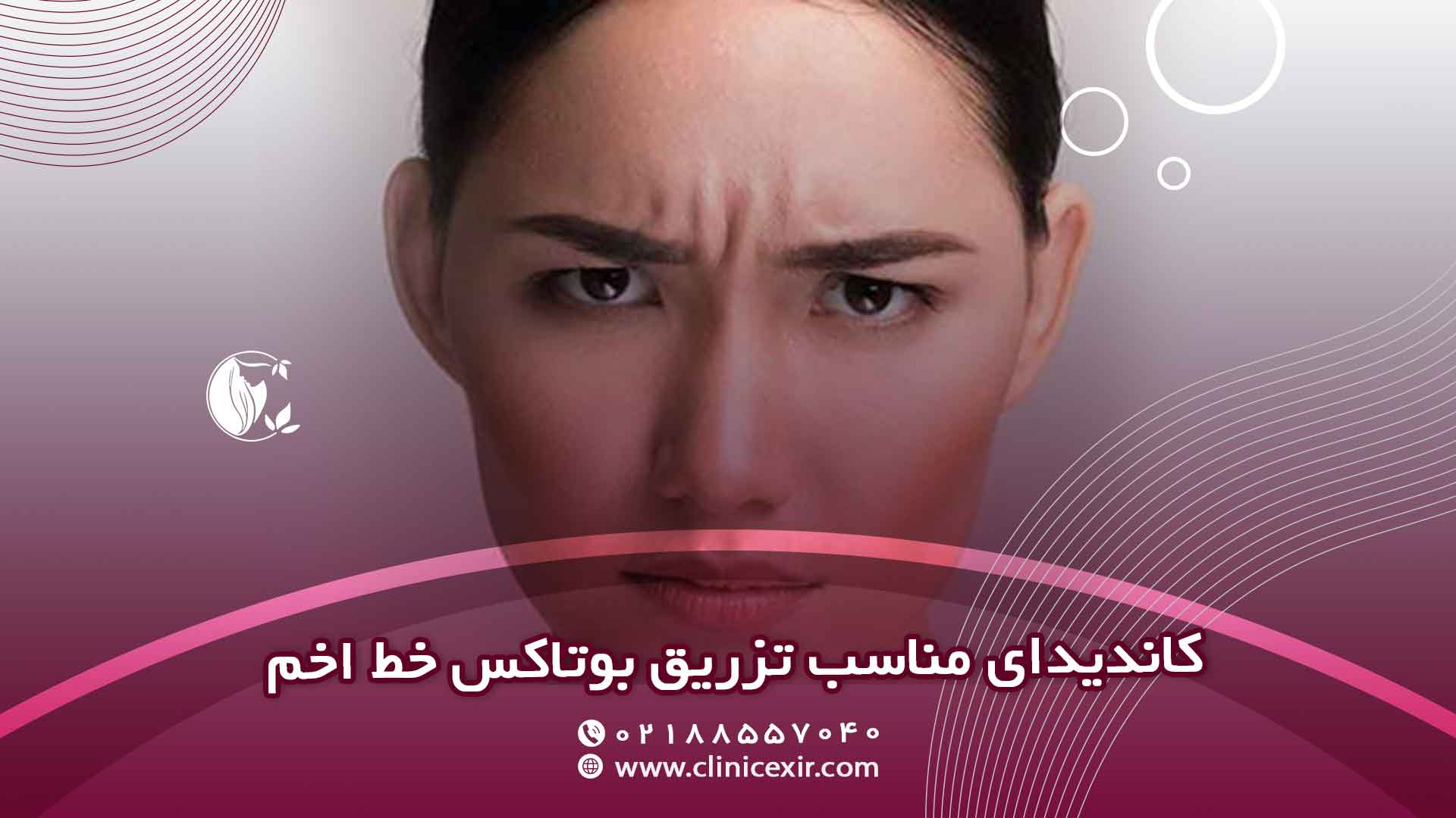 چه افرادی کاندیدای مناسبی برای تزریق بوتاکس خط اخم هستند؟