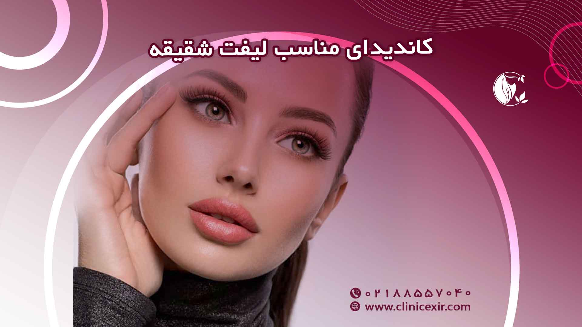 کاندید مناسب لیفت شقیقه 