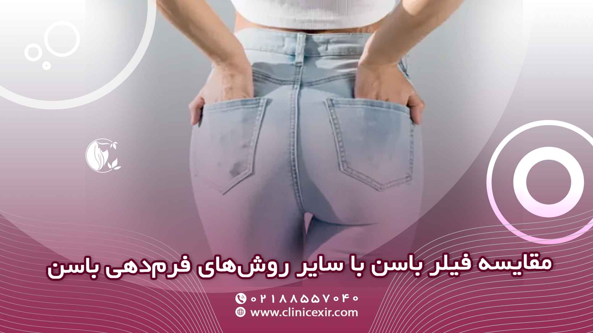 تزریق فیلر باسن