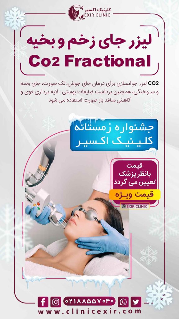 هزینه لیزر جای زخم و بقیه