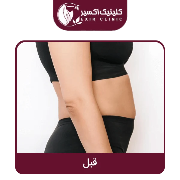 عکس قبل لاغری